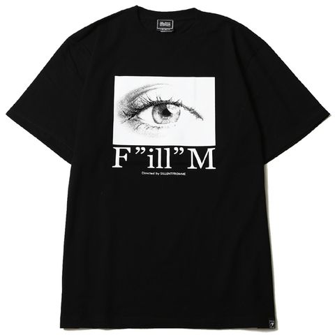 EYE-